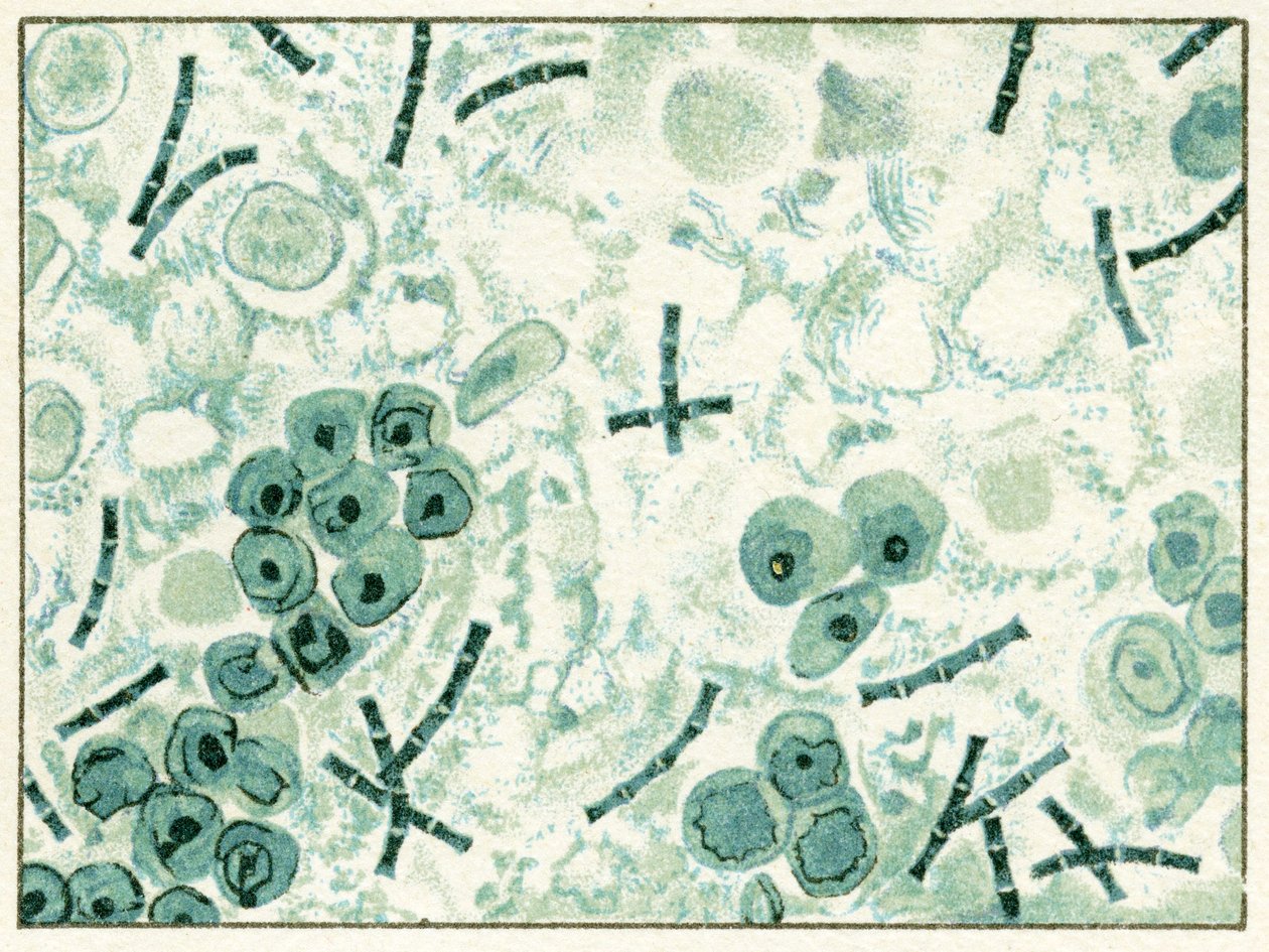 amostra de Bactérias Antraz no sangue c.1890 (cromolitografia colorida) de German School