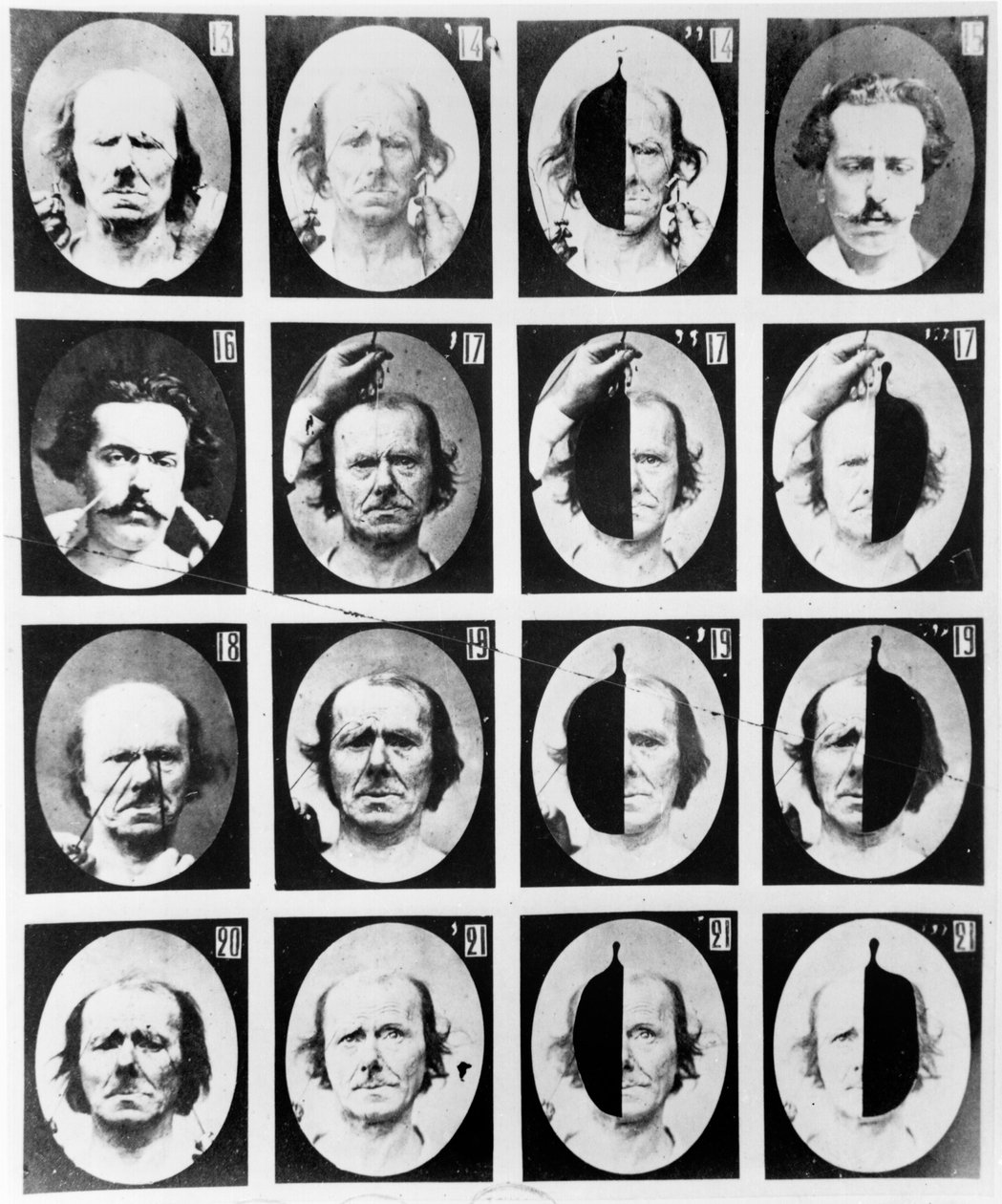 Estudos fisionômicos, de "Mecanismo da fisiologia humana ou análise eletrofisiológica das paixões", de Duchenne de Boulogne, publicado em 1876, Paris de Guillaume Benjamin Armand Duchenne de Boulogne