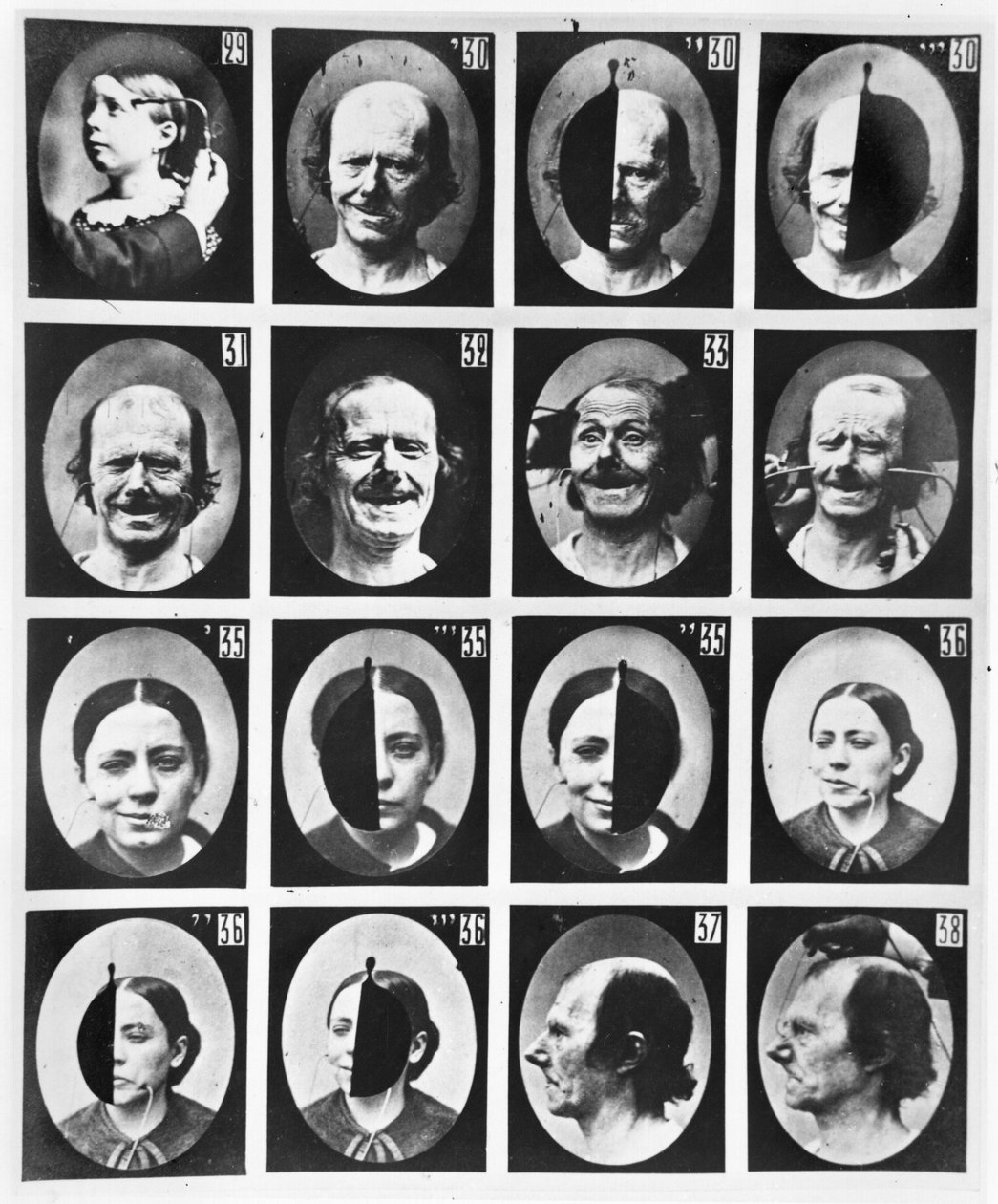 Estudos fisionômicos, de "Mecanismo da fisiologia humana ou análise eletrofisiológica das paixões", de Duchenne de Boulogne, publicado em 1876, Paris de Guillaume Benjamin Armand Duchenne de Boulogne