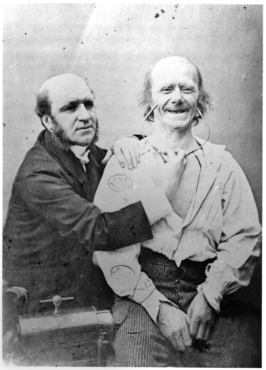 Faradização do músculo frontal, de "Mecanismo da fisionomia humana ou análise eletrofisiológica das paixões", de Duchenne de Boulogne, publicado em 1876, Paris de Guillaume Benjamin Armand Duchenne de Boulogne