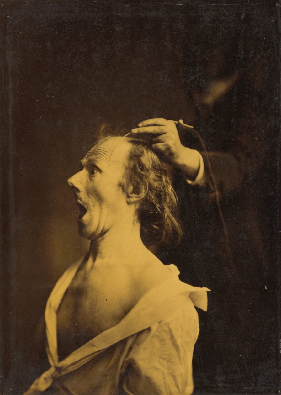 Espanto, estupefação, espanto,1854-1856, impresso em 1862 (foto) de Guillaume Benjamin Armand Duchenne de Boulogne