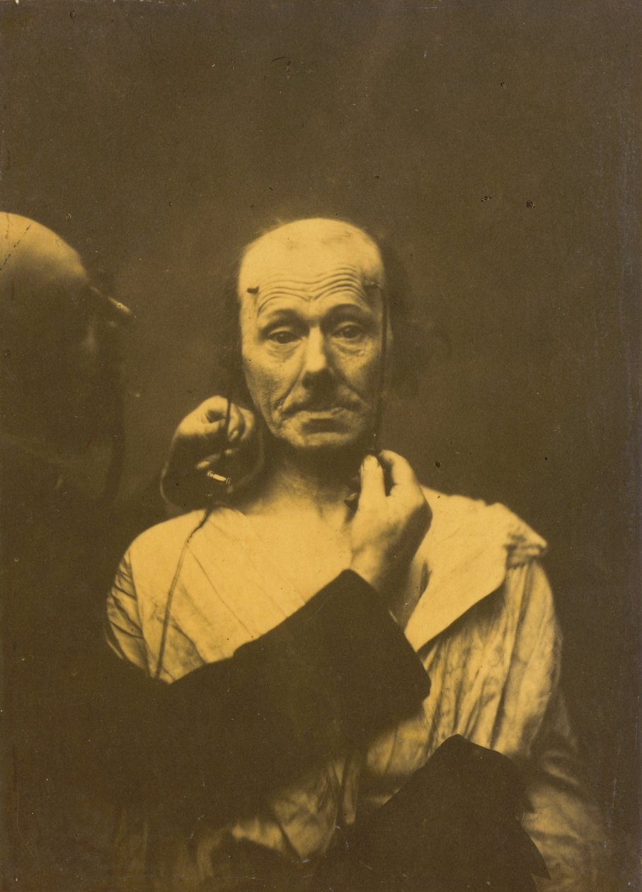 Atenção,1854-1856, impresso em 1862 (foto) de Guillaume Benjamin Armand Duchenne de Boulogne