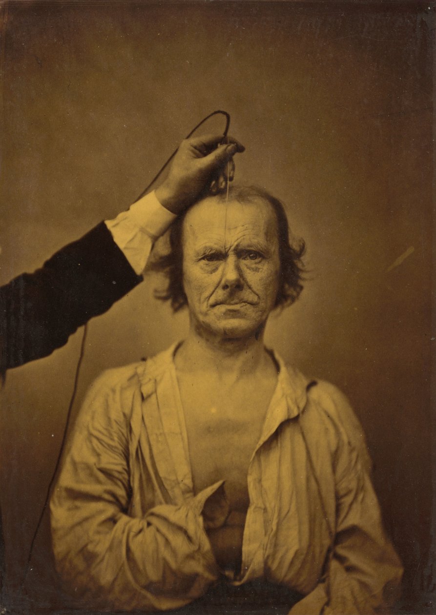 Atenção (esquerda); severidade, agressividade (direita),1854-1856, impresso em 1862 (foto) de Guillaume Benjamin Armand Duchenne de Boulogne