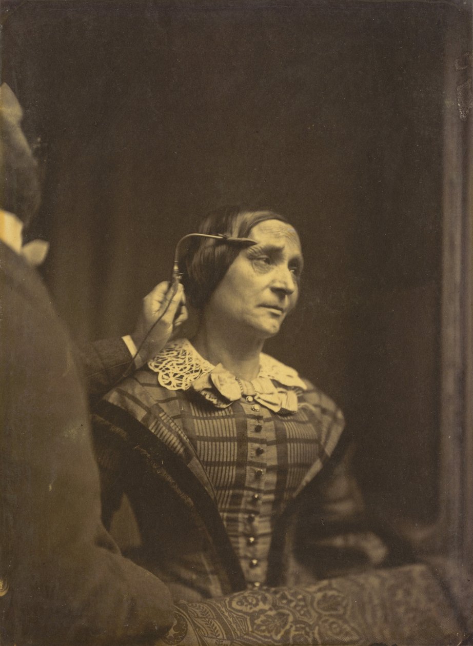 Atenção, olhar atento (esquerda); Atenção dolorosa (direita),1854-1856, impresso em 1862 (foto) de Guillaume Benjamin Armand Duchenne de Boulogne