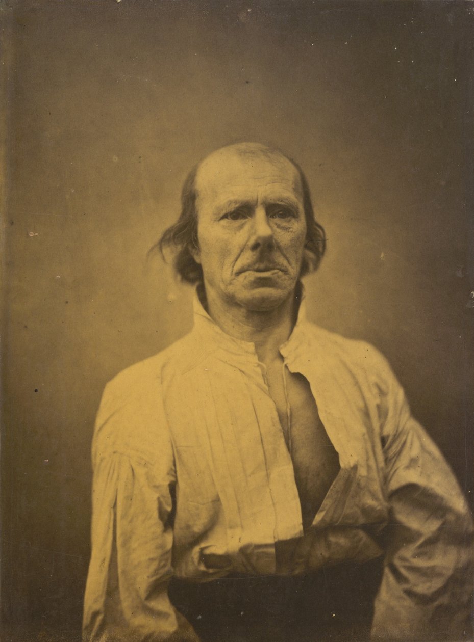 Rosto em repouso,1854-1856, impresso em 1862 (fotografia) de Guillaume Benjamin Armand Duchenne de Boulogne