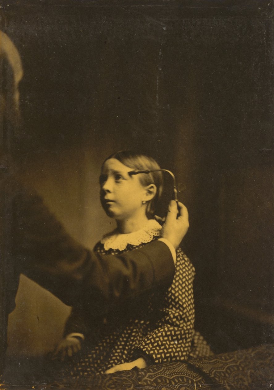 Memórias dolorosas,1854-1856, impresso em 1862 (foto) de Guillaume-Benjamin-Armand Duchenne de Boulogne