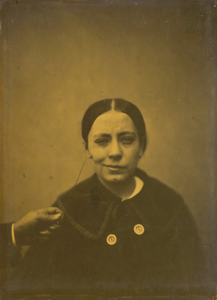 Ligeiro abaixamento do ângulo da boca devido a depressão (esquerda); falso riso (direita),1854-1856, impresso em 1862 (foto) de Guillaume Benjamin Armand Duchenne de Boulogne