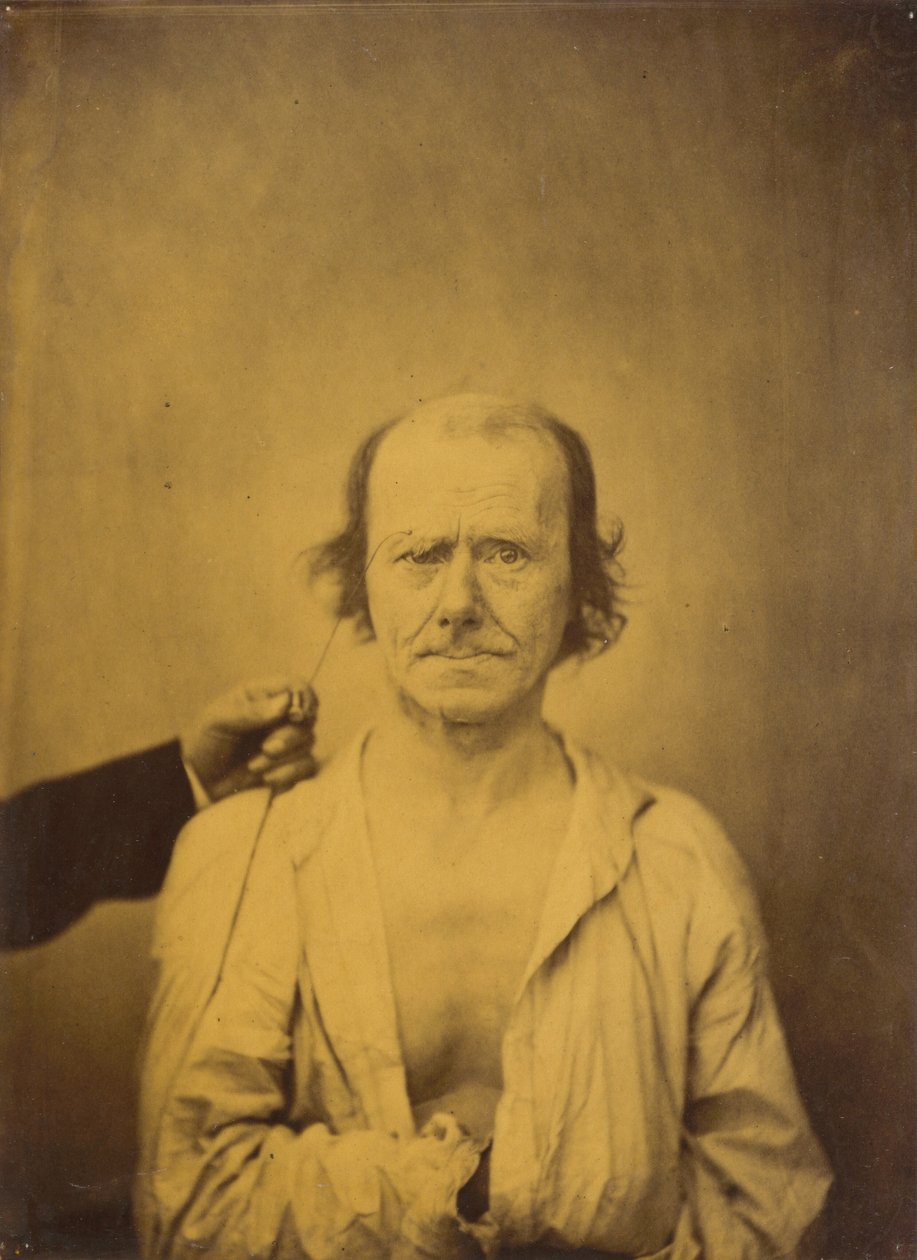 Atenção (esquerda); Reflexão (direita) de Guillaume Benjamin Amant Duchenne