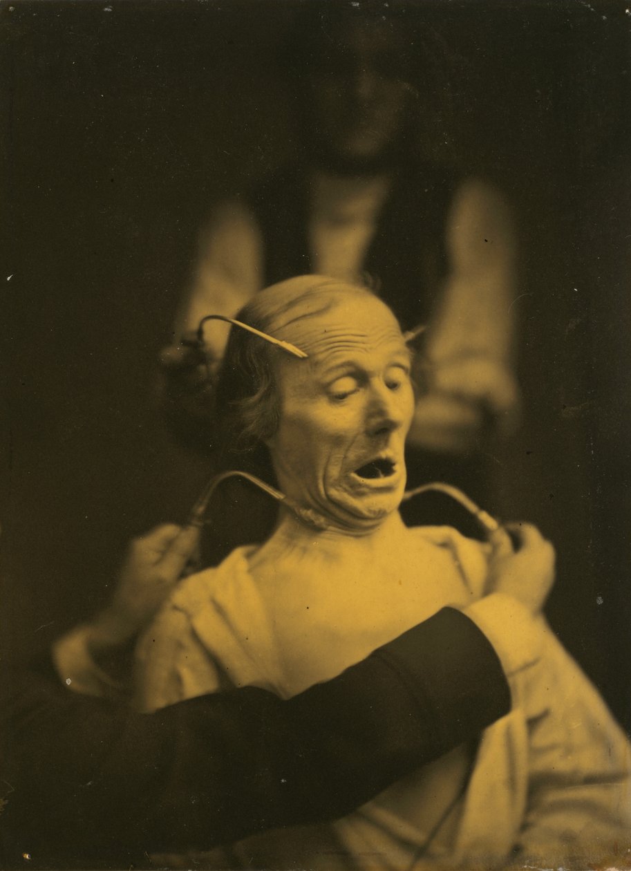 Expressão de terror de Guillaume Benjamin Amant Duchenne