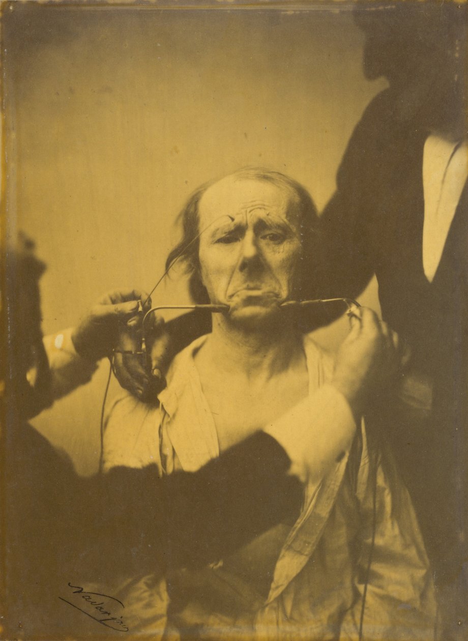 Dor e desespero de Guillaume Benjamin Amant Duchenne