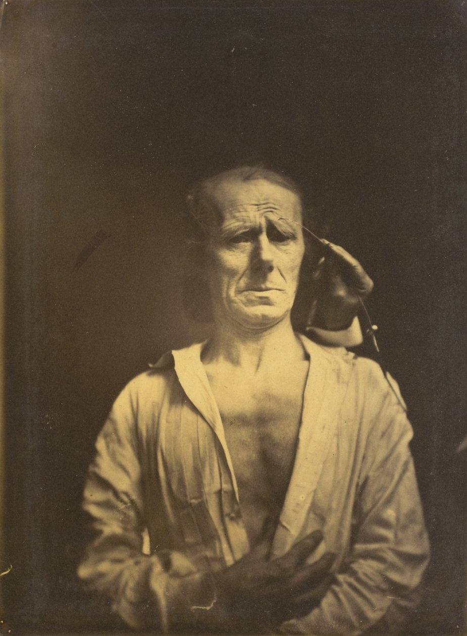 Espasmo de m. corrugator supercilii sob luz muito forte (esquerda); Um rosto relaxado (fotografado em pleno sol) (à direita) de Guillaume Benjamin Amant Duchenne