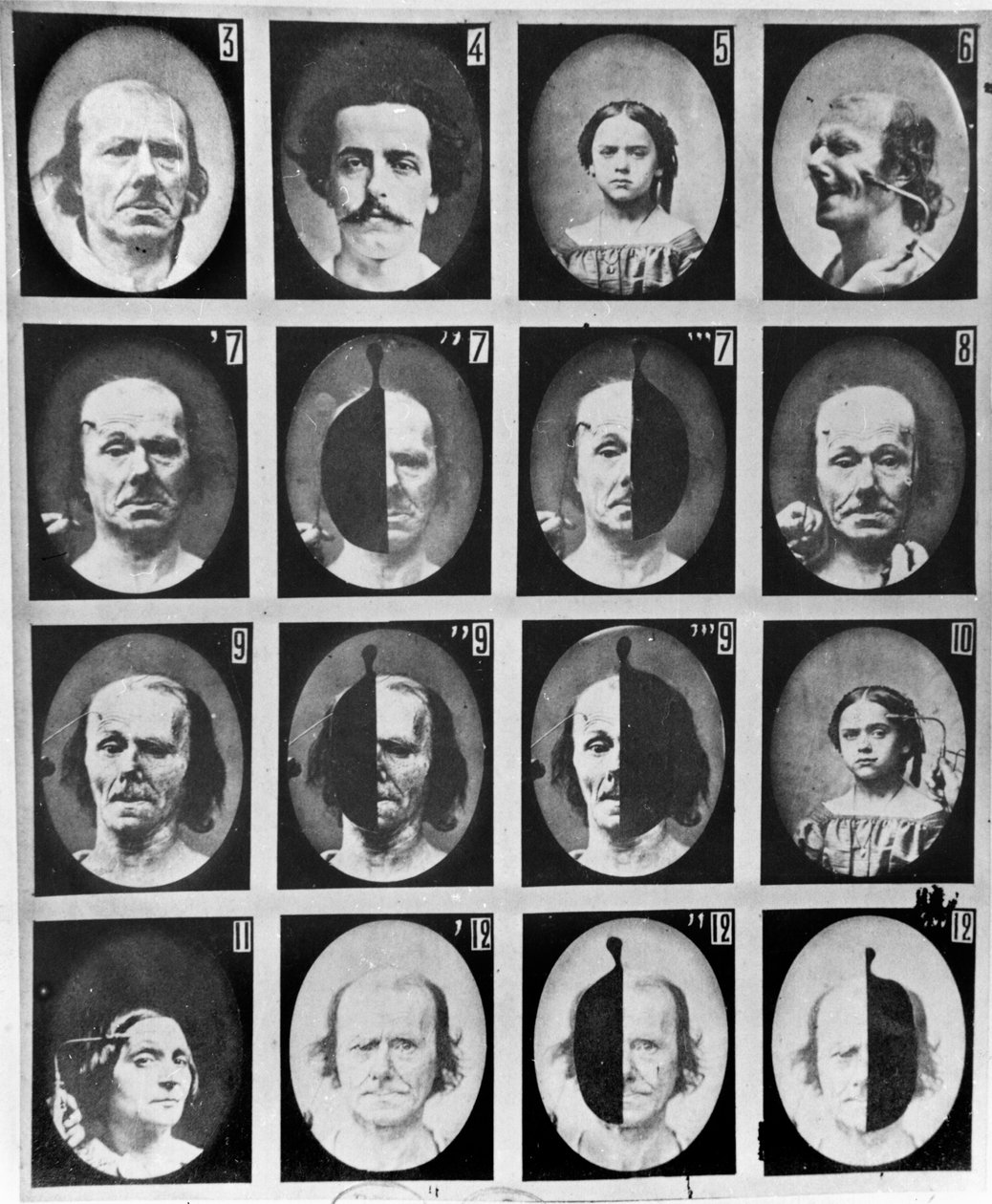 Estudos fisionômicos, de "Mecanismo da fisiologia humana ou análise eletrofisiológica das paixões", de Duchenne de Boulogne, publicado em 1876, Paris de Guillaume Benjamin Armand Duchenne de Boulogne