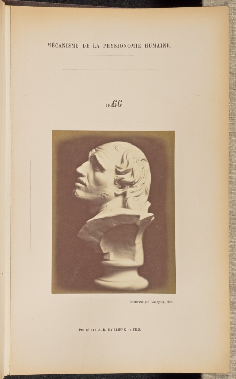 Fig. 66 de Guillaume Benjamin Duchenne
