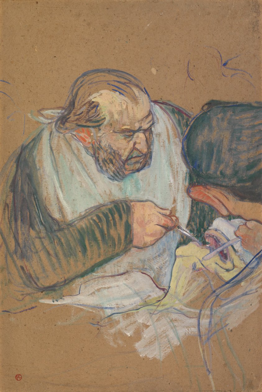 Dr. Péan a operar de Henri de Toulouse-Lautrec