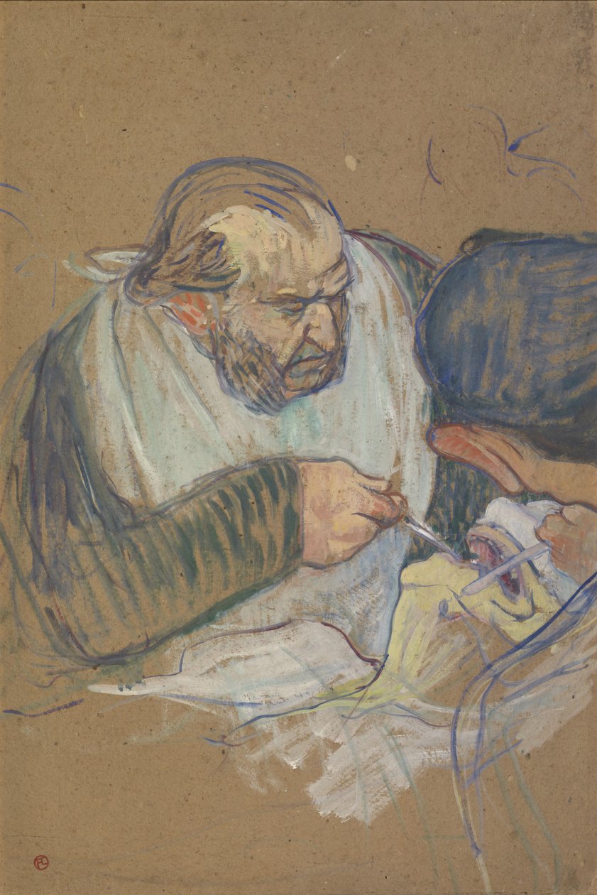 Dr. Péan Operating, 1891-92 de Henri de Toulouse Lautrec