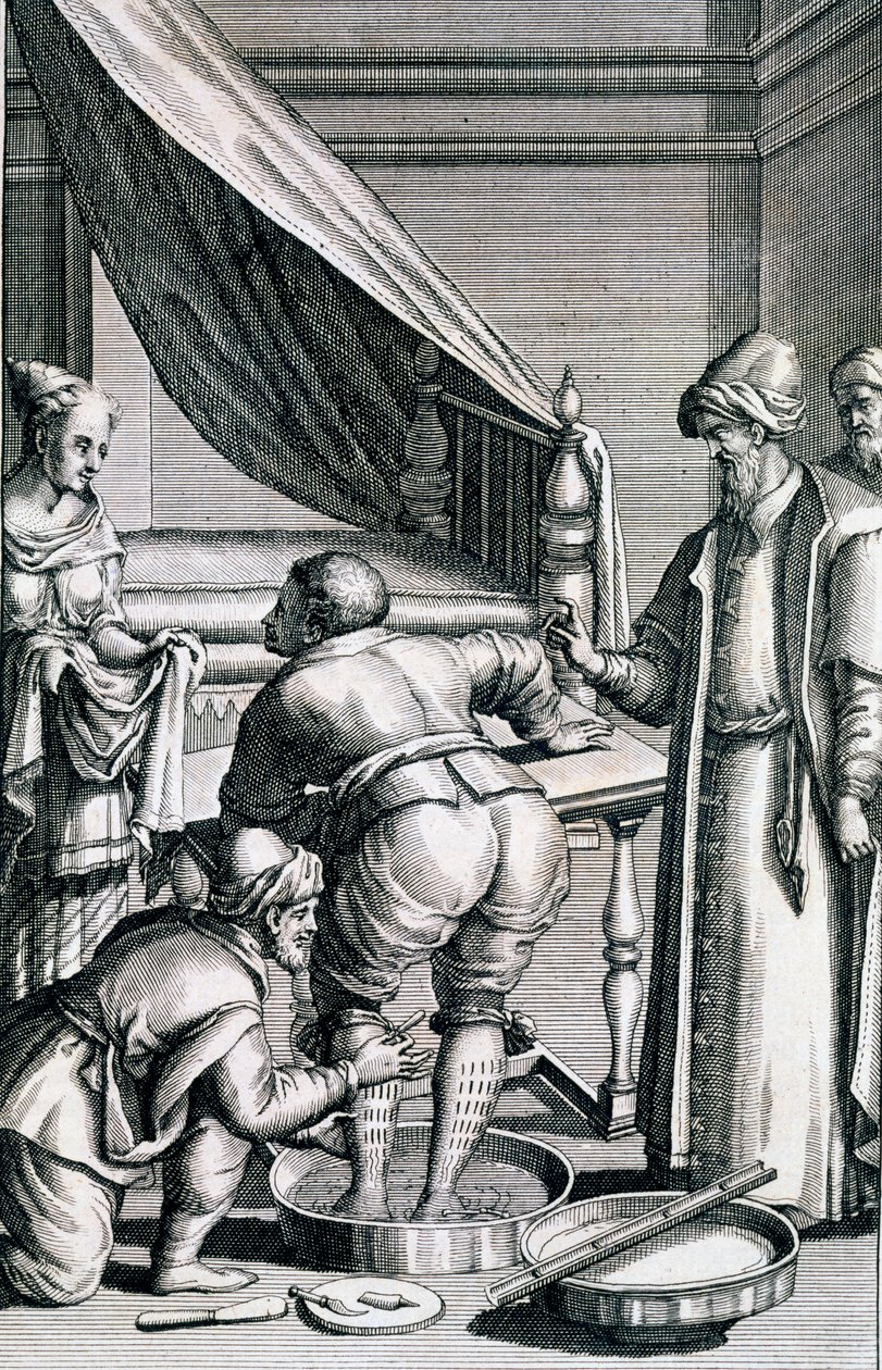 Sangria nas pernas, de Medicina Aegyptiorum por Prospero Alpini, publicado em 1745 de Italian School