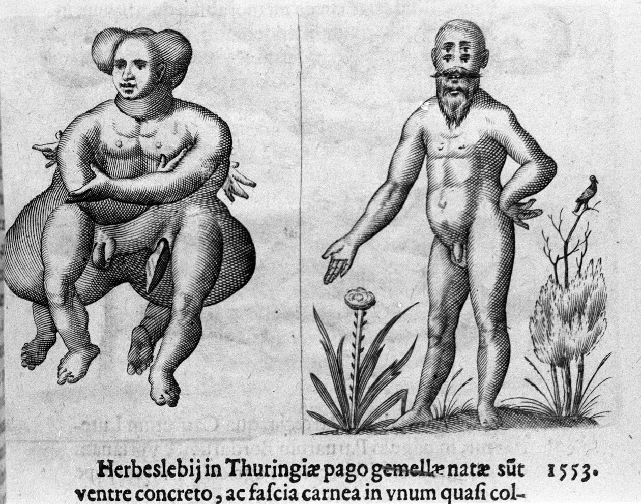 Diferentes tipos de monstros humanos. Gravura de "De monstrorum natura, causis et differentiis" de Fortunio Liceti (1577-1656), cientista italiano. 1646 de Italian School