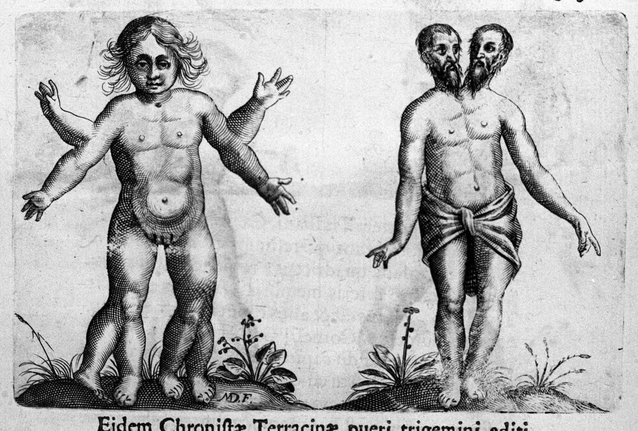 Diferentes tipos de monstros humanos gravados de "De monstrorum natura, causis et differentiis" de Fortunio Liceti (1577-1656), cientista italiano. 1646 de Italian School