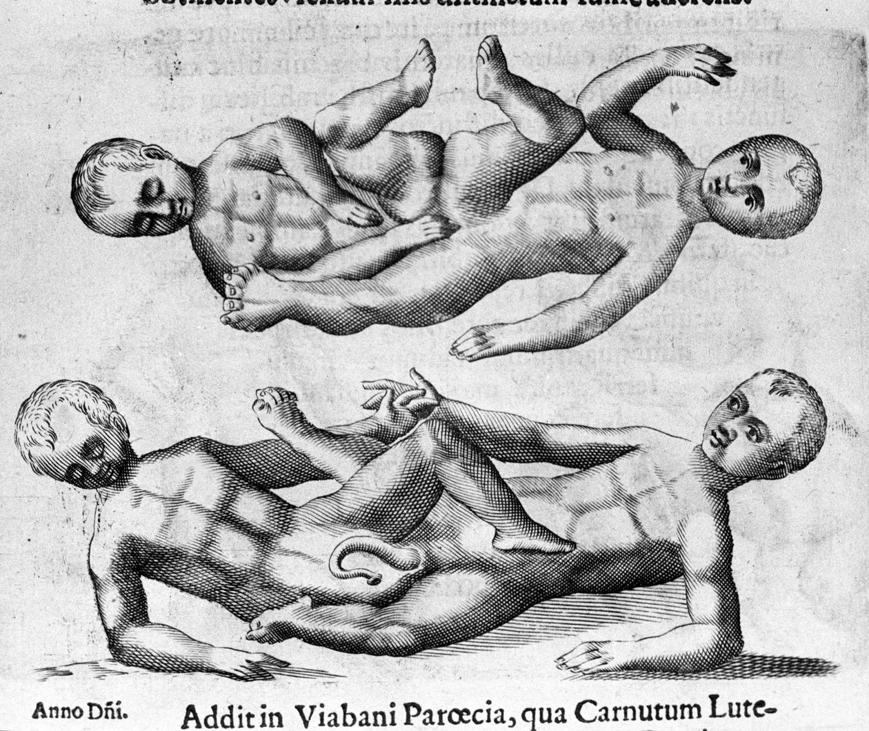 Diferentes tipos de monstros humanos: Crianças siamesas ligadas pela pélvis. Gravura de "De monstrorum natura, causis et differentiis" de Fortunio Liceti (1577-1656), cientista italiano. 1646 de Italian School