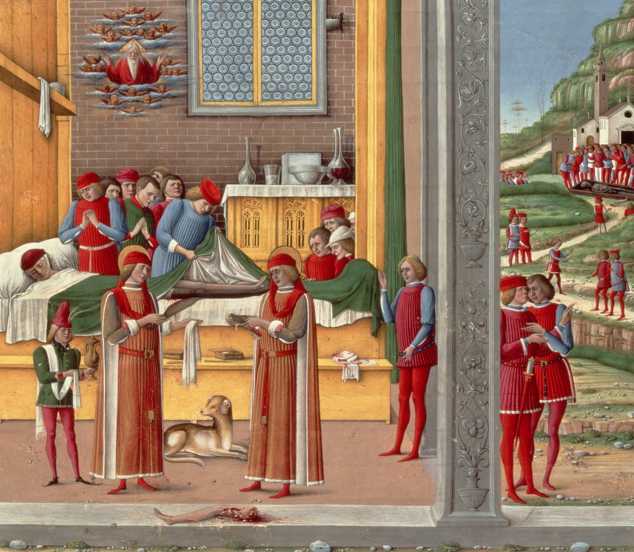 Cena de amputação medieval (tempera no painel) de Italian School