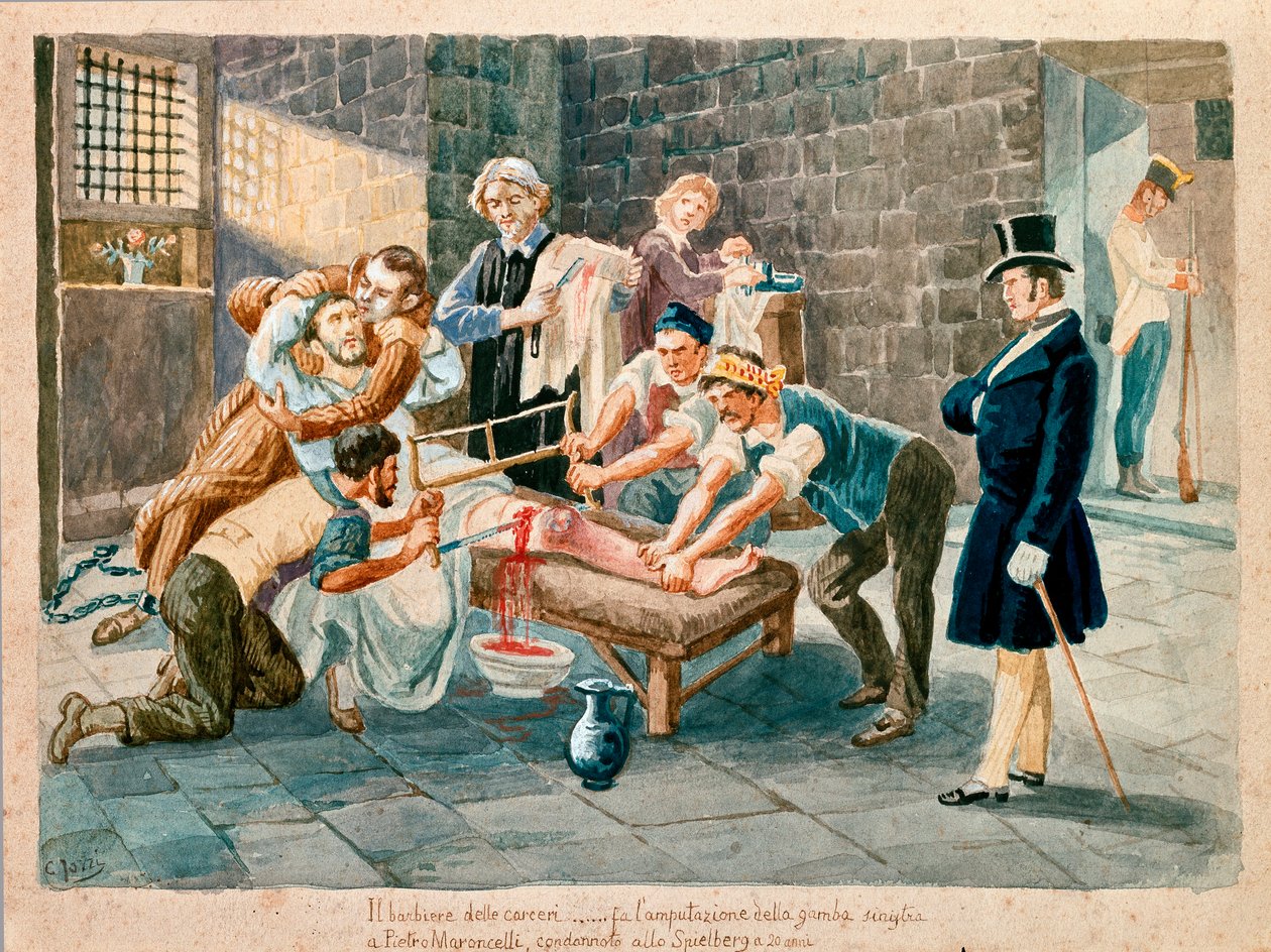 Patriota e membro da Carboneria Pietro Maroncelli (1795-1846) foi amputado de sua perna durante sua prisão no penitenciário da fortaleza de Spielberg, na Morávia. Gravuras do Museo del Risorgimento do século XIX, Milão de Italian School