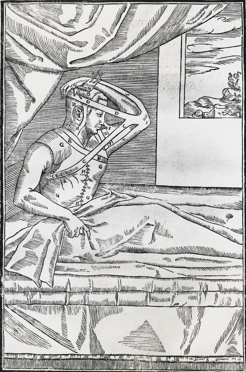 Cirurgia de rinoplastia na qual o nariz do paciente estava preso ao retalho de pele do braço. de Italian School