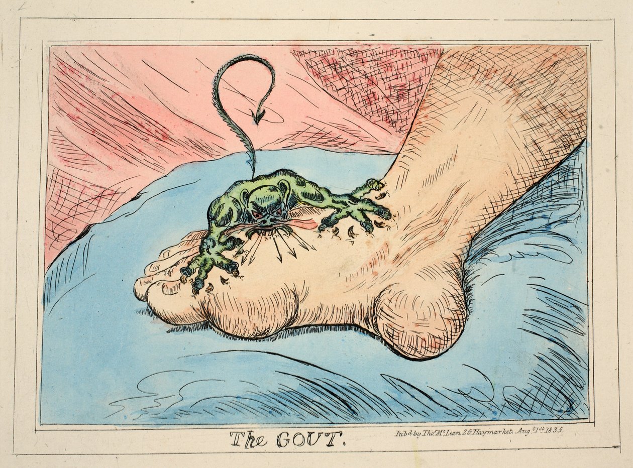 A gota, pub. 1835 (gravura colorida à mão) de James Gillray