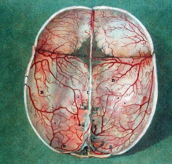 The Brain, de 