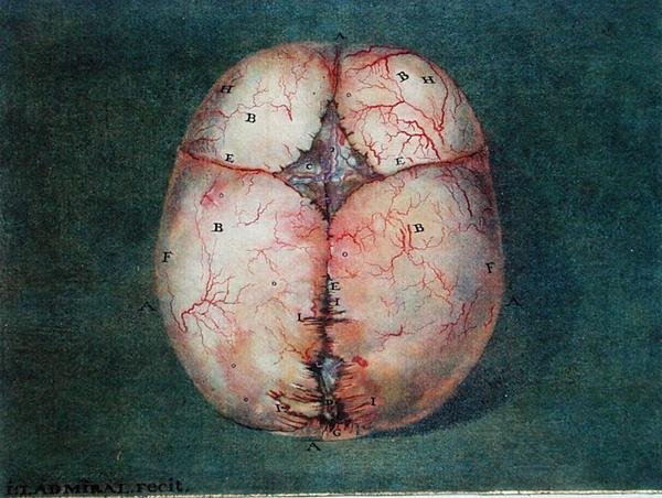 The Brain, de 