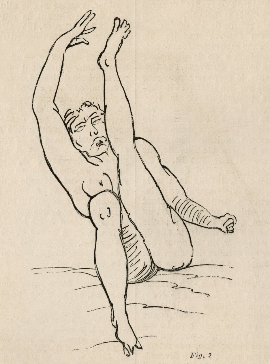 Epilepsia histérica, ataque, contorções, figo. 2 de &39;Iconografia fotográfica de La Salpetriere&39; de Bourneville e P. Regnard, Paris, 1876 de Jean Francois Badoureau