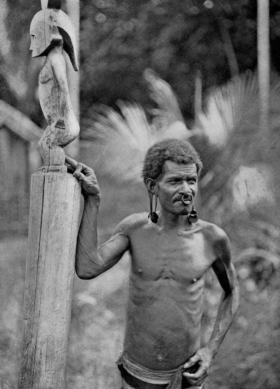 Malformação das orelhas, Ilhas Salomão, 1920. de John Watt Beattie