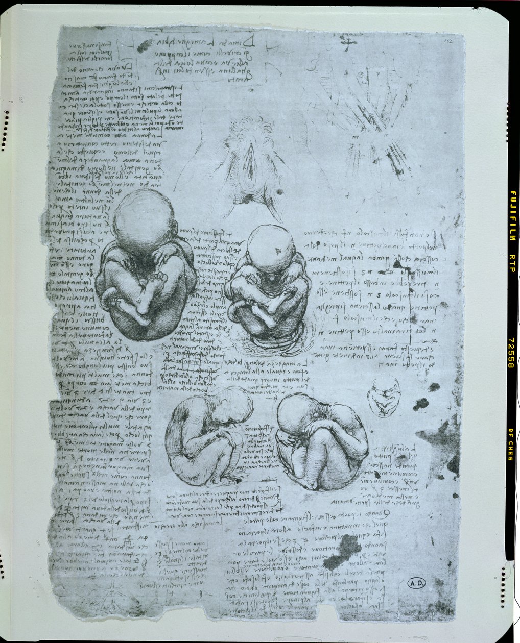 Cinco visões de um feto no útero, cópia fac-símile de Leonardo da Vinci