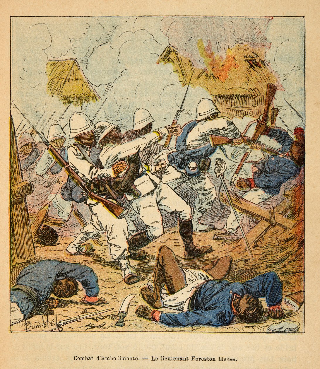 A Guerra em Madagáscar - História das Expedições Francesas de 1885-1895 por Henri Galli dit Galllichet (1854-1922), ilustrada por Louis Bombled (1862-1927): As feridas do Tenente Foreston durante as batalhas de Ambolomonty em 1895, Coleção Particular de Louis Charles Bombled