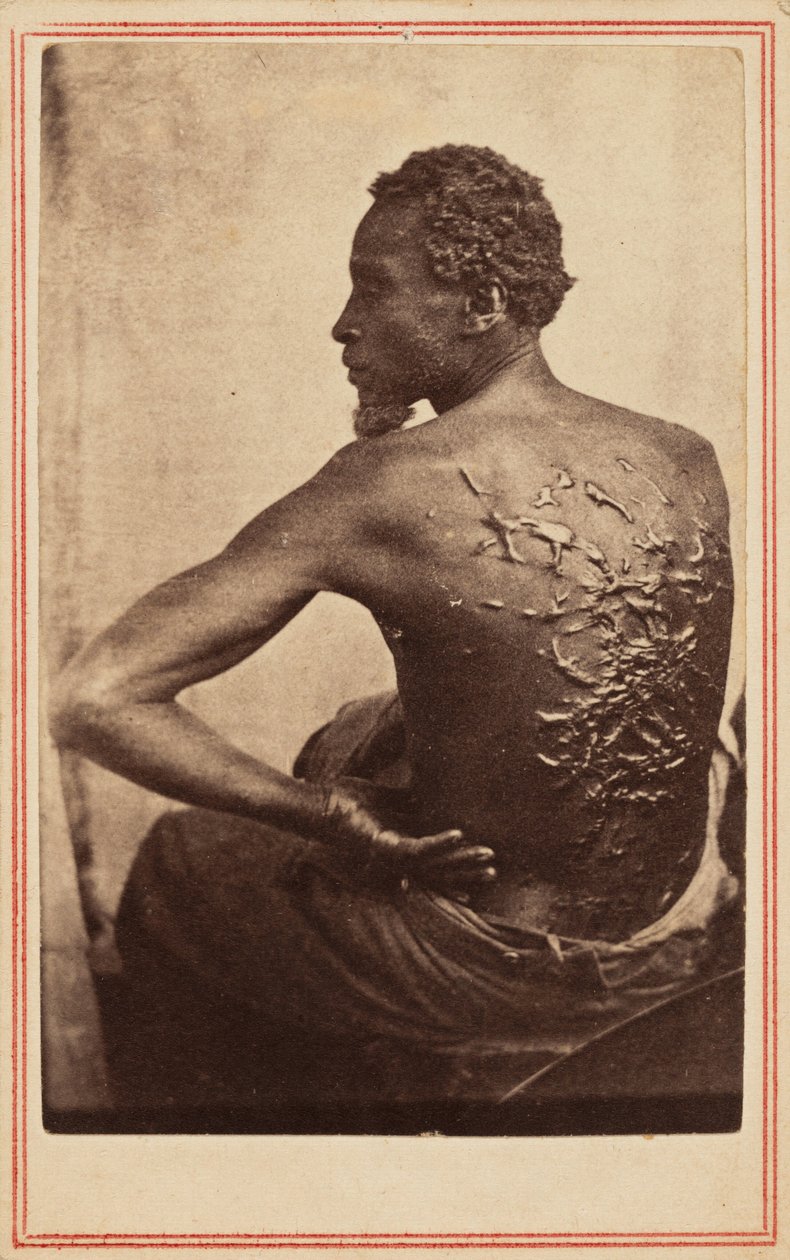 O dorso flagelado,c. 1863 (foto) de McPherson & Oliver