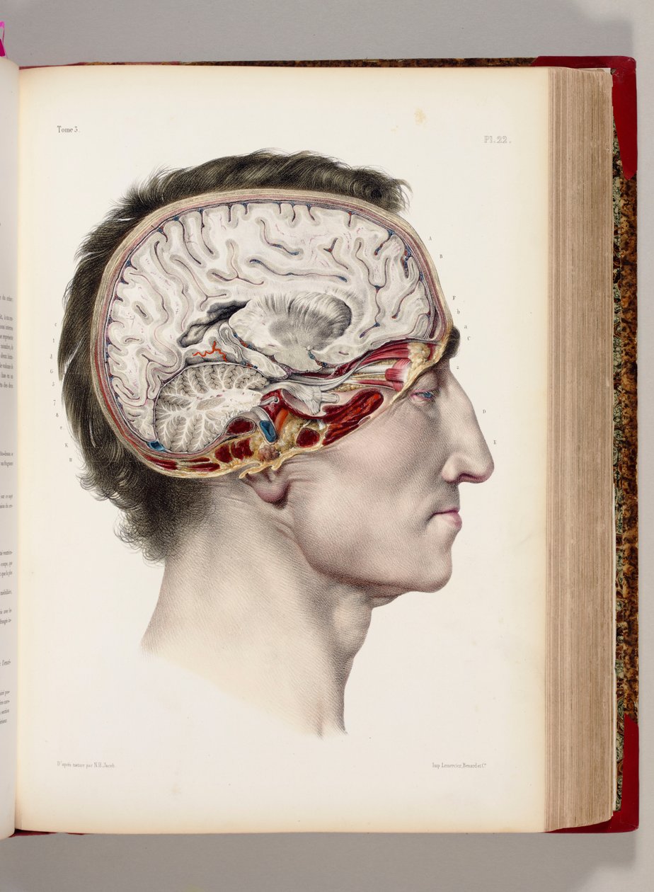 Litografia colorida à mão de uma cabeça dissecada em perfil mostrando o cérebro, de "Traite Complet of the Anatomie of l&39;Homme, Comprendre la Medicine Operatoire", 1831-54 de Nicolas Henri Jacob