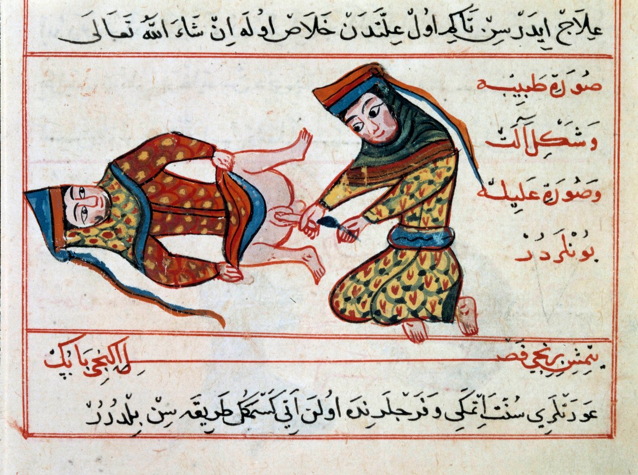 Medicina: operação de uma hermafodite. Miniatura de um Tratamento de Medicina Turca por Sharaf al-din de Ottoman School