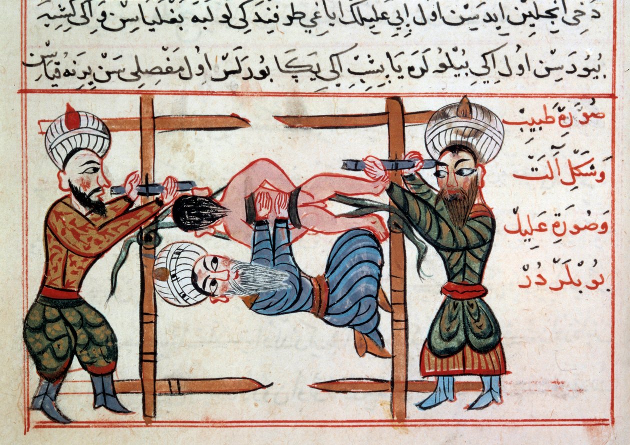 Redução de uma fractura. Miniatura de um Tratamento de Medicina Turca por Sharaf al-din de Ottoman School