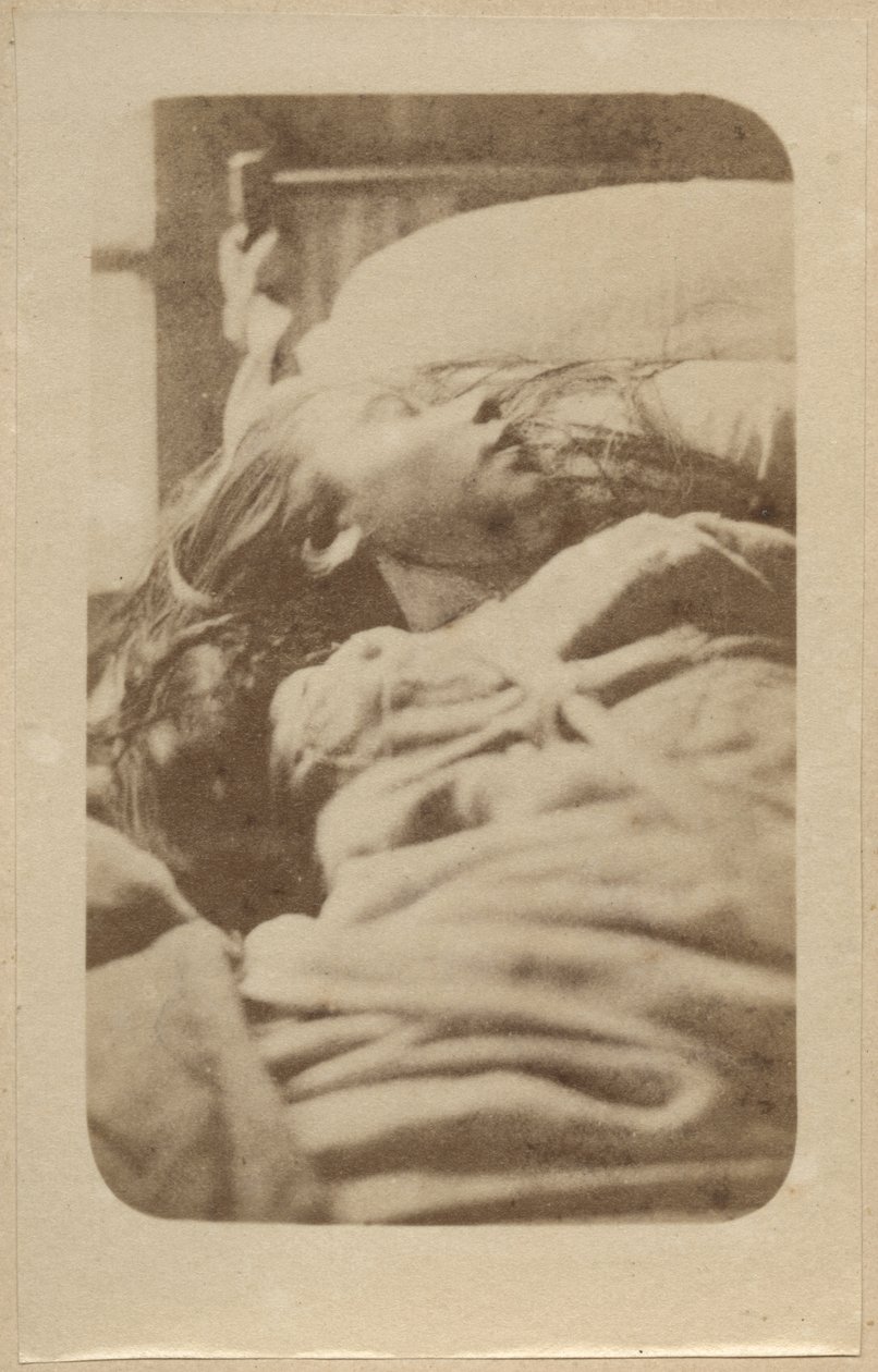 Ataque da histeria, primeira fase, ilustração da &39;Iconografia Fotográfica de La Salpetriere&39; de Bourneville et P. Regnard, placa II, Paris, 1876 (impressão de albume) de Paul Regnard