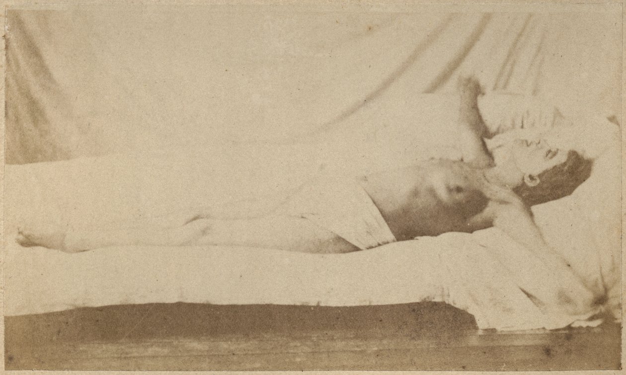 Epilepsia histérica, ataque, crucificação, placa VI de &39;Iconografia fotográfica de La Salpetriere&39; por Bourneville e P. Regnard, Paris, 1876 (impressão albumen) de Paul Regnard