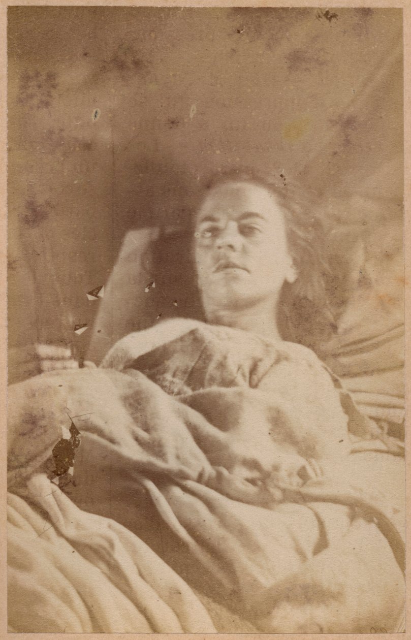 Epilepsia histérica, ataque, terceiro período, prato XXVI da &39;Iconografia Fotográfica de La Salpetriere&39; de Bourneville et P. Regnard, Paris, 1876 (impressão albumen) de Paul Regnard