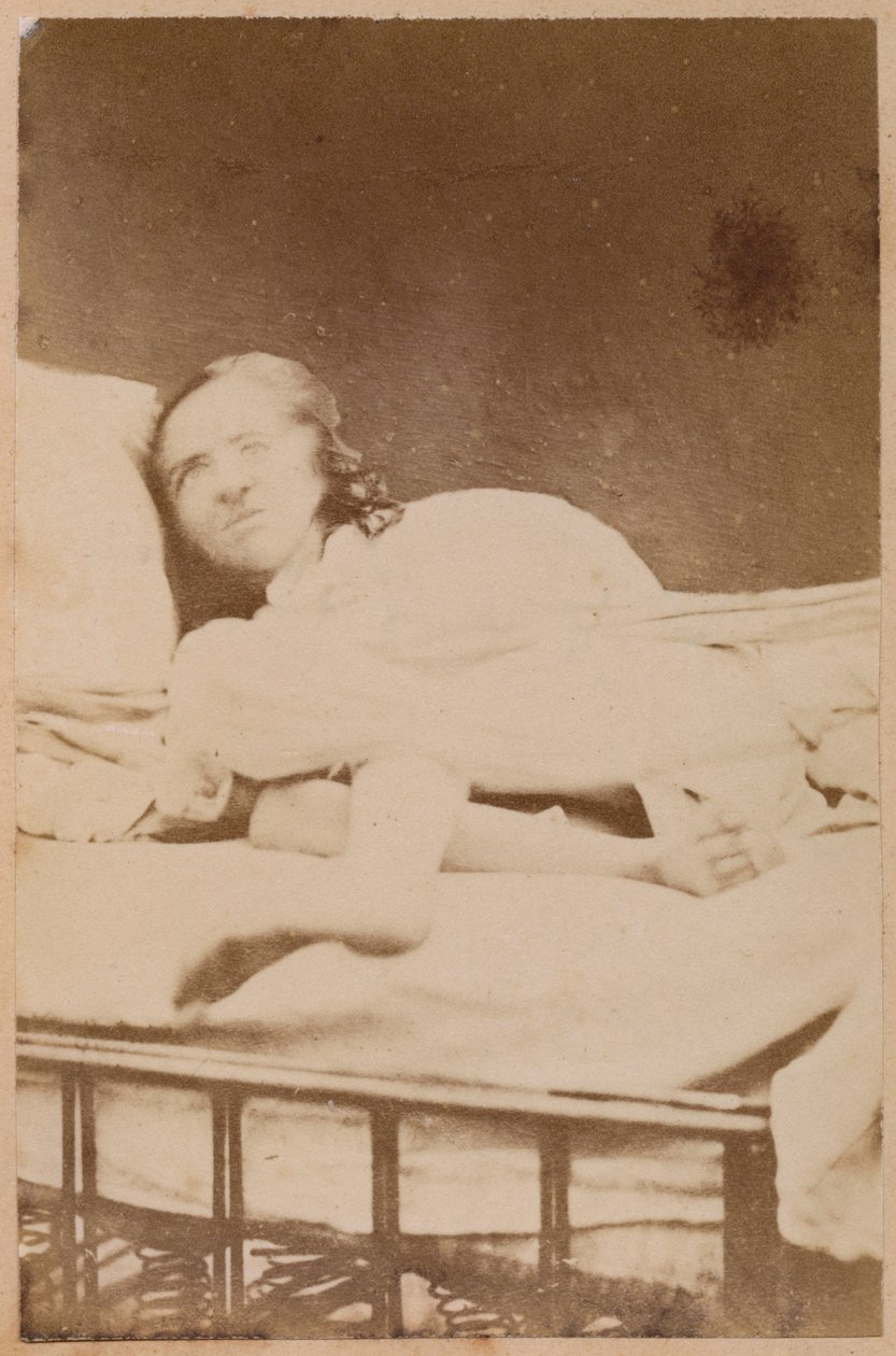 Epilepsia histérica, contorções, placa XXXVIII de &39;Iconografia fotográfica de La Salpetriere&39; por Bourneville e P. Regnard, Paris, 1876 (albumen print) de Paul Regnard