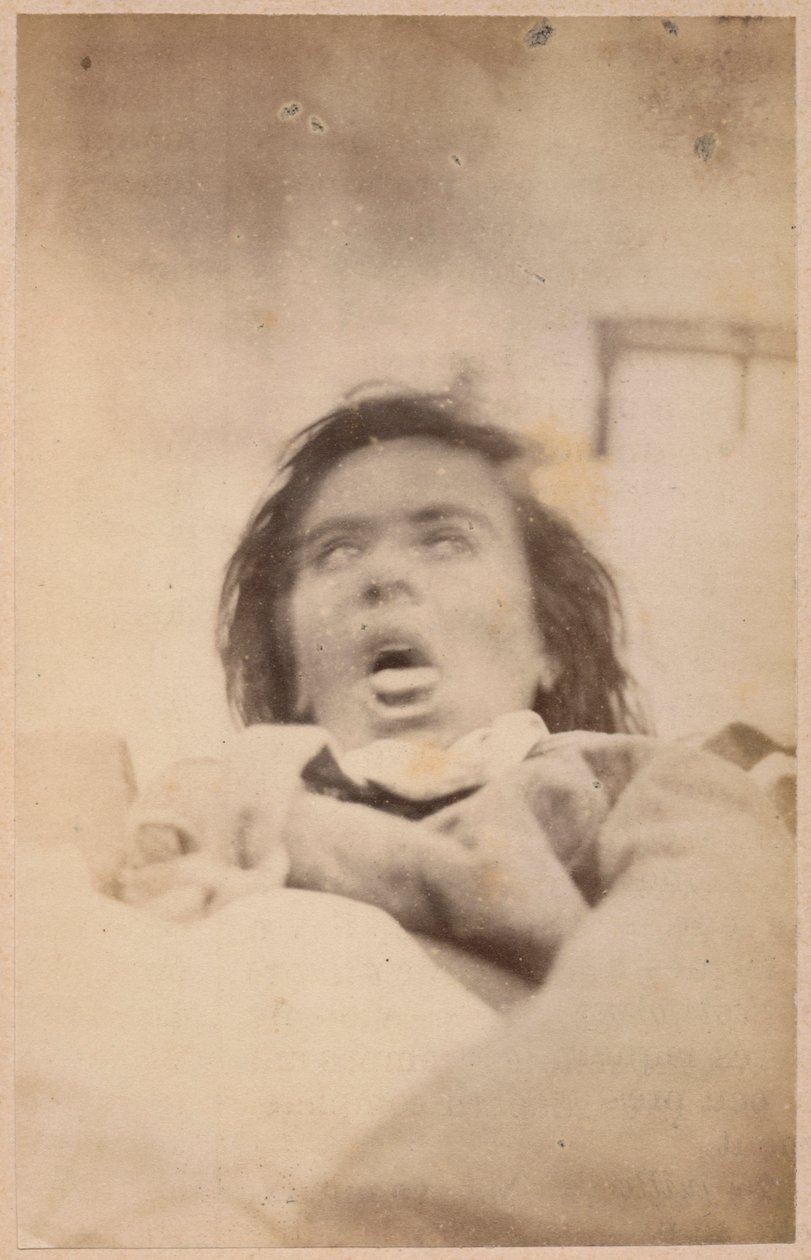Epilepsia histérica, alucinações, angústia, plano XXIX da &39;Iconografia fotográfica de La Salpetriere&39; de Bourneville e P. Regnard, Paris, 1876 (impressão de albume) de Paul Regnard