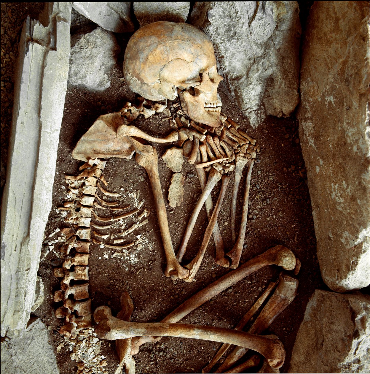 Pré-história: esqueleto feminino da caverna da Candide Arene (Finale Ligure). Idade da pedra, neolítico. Genes, Museo di archeologia Ligure de Prehistoric Prehistoric