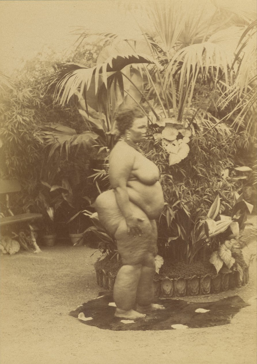 Mulher africana de Prince Roland Napoleon Bonaparte