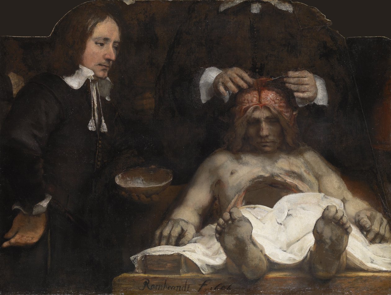 A lição de anatomia do Dr. Jan Deyman, 1656 de Rembrandt van Rijn