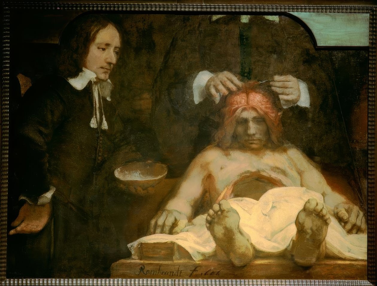 A anatomia do Dr. Ing. Johan Deijman de Rembrandt van Rijn