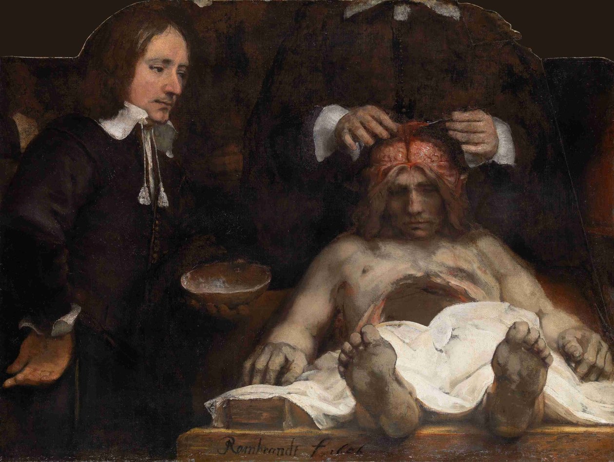 A lição de anatomia do Dr. Jan Deijman, 1656 de Rembrandt van Rijn