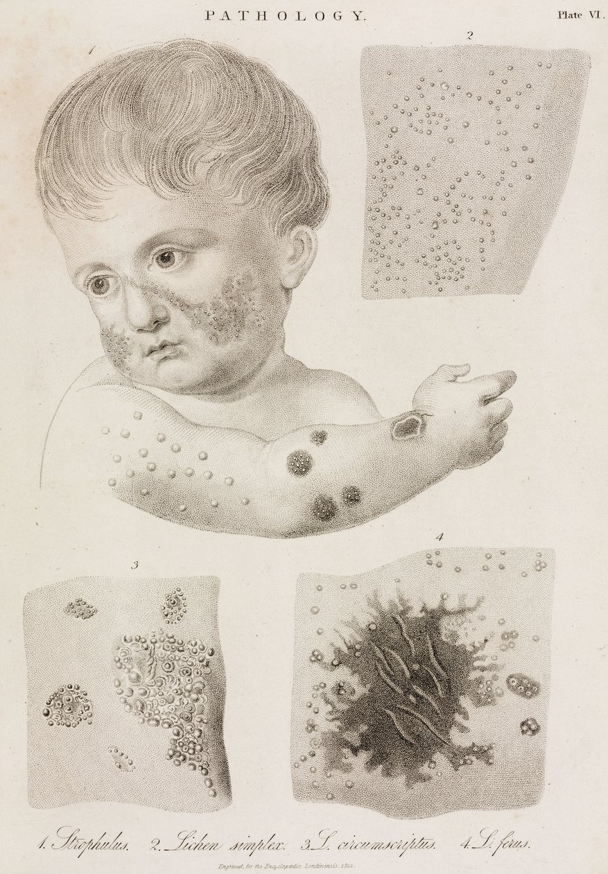 Dermatologia Tipos de doenças de pele de John Pardon