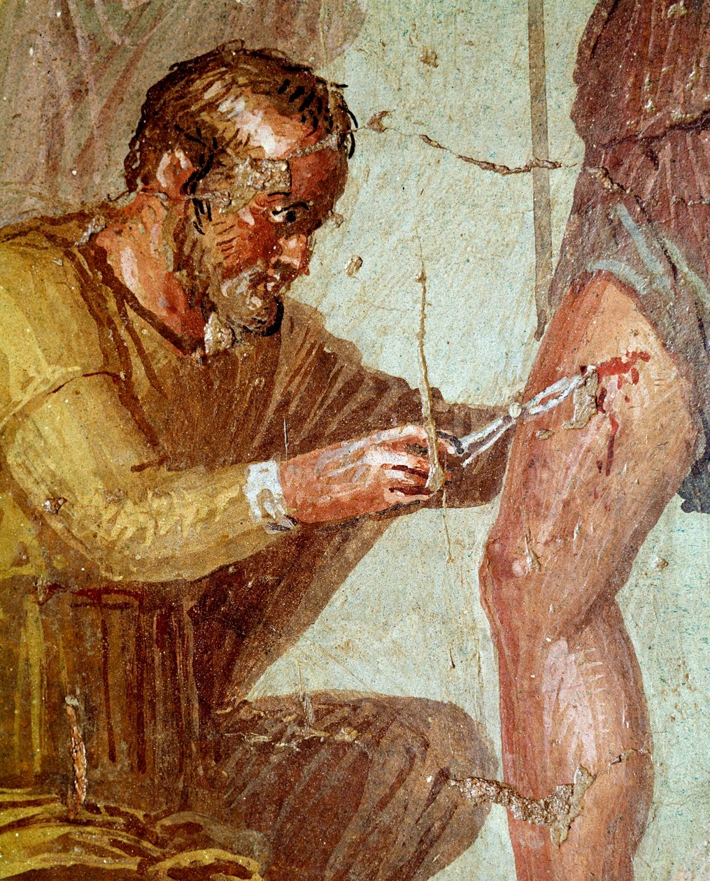 Eneias ferido é tratado por Iapixe, ajudado por Vénus (fresco, 54-79 d.C.) de Roman