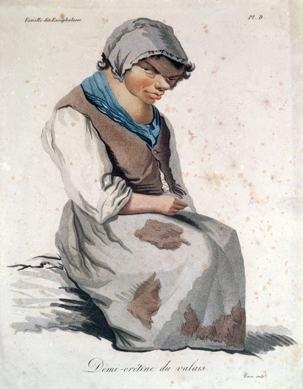 Cretino de Valais (gravura a cores) de Salvadore Tresca